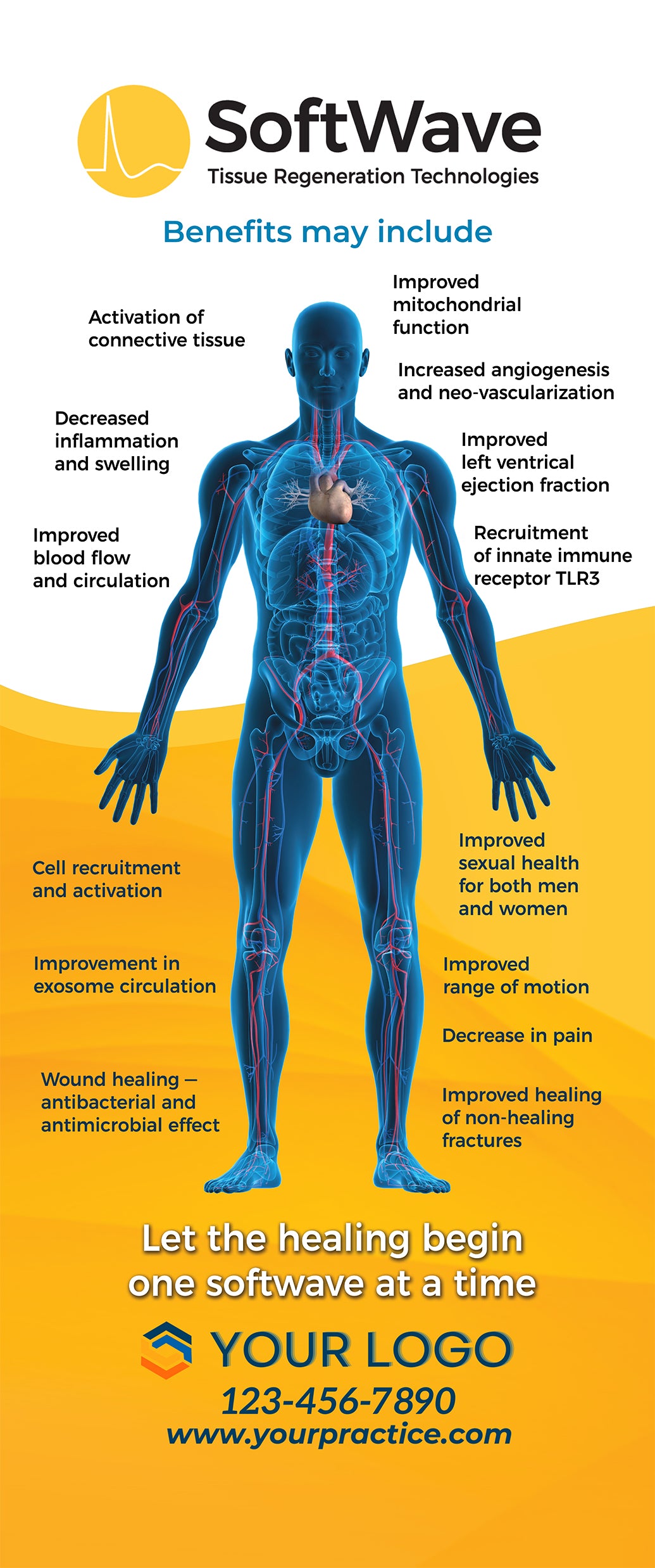 34"x81" Customized SoftWave Retractable Banner Stand